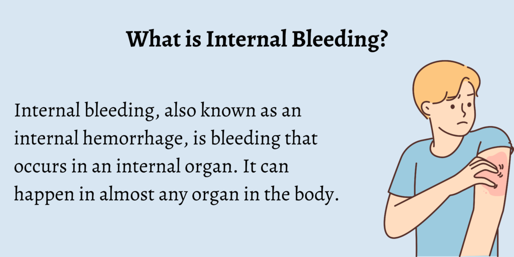 Emergency Treatment for Internal Bleeding