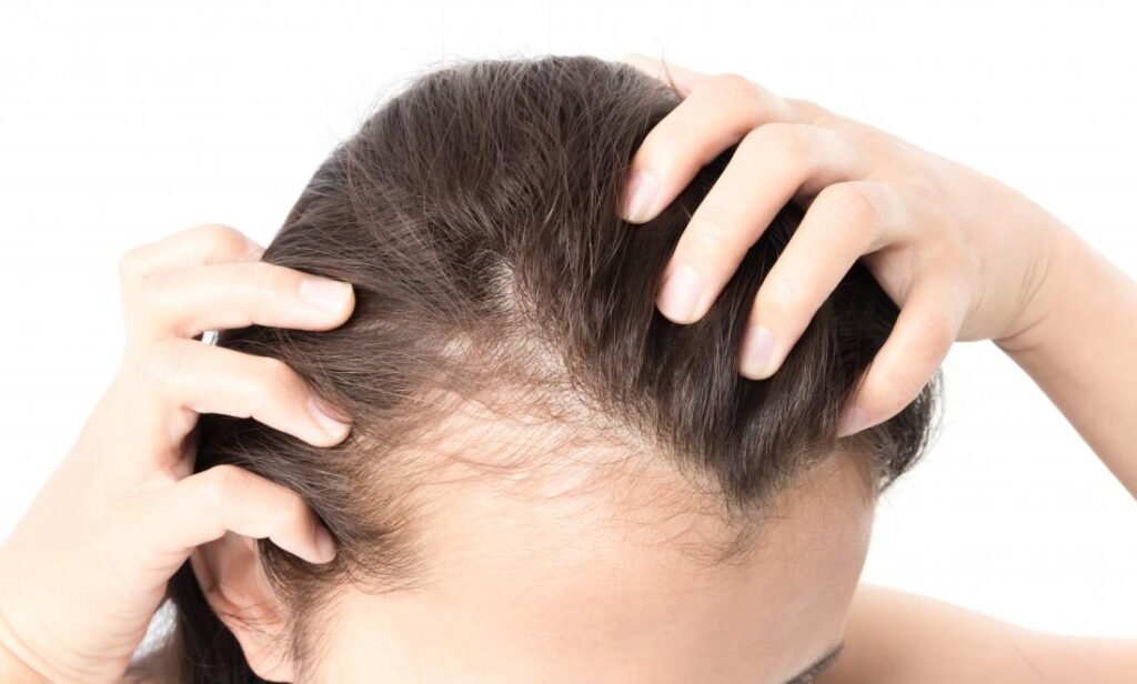 Essential Hair Care Tips for Balding Women