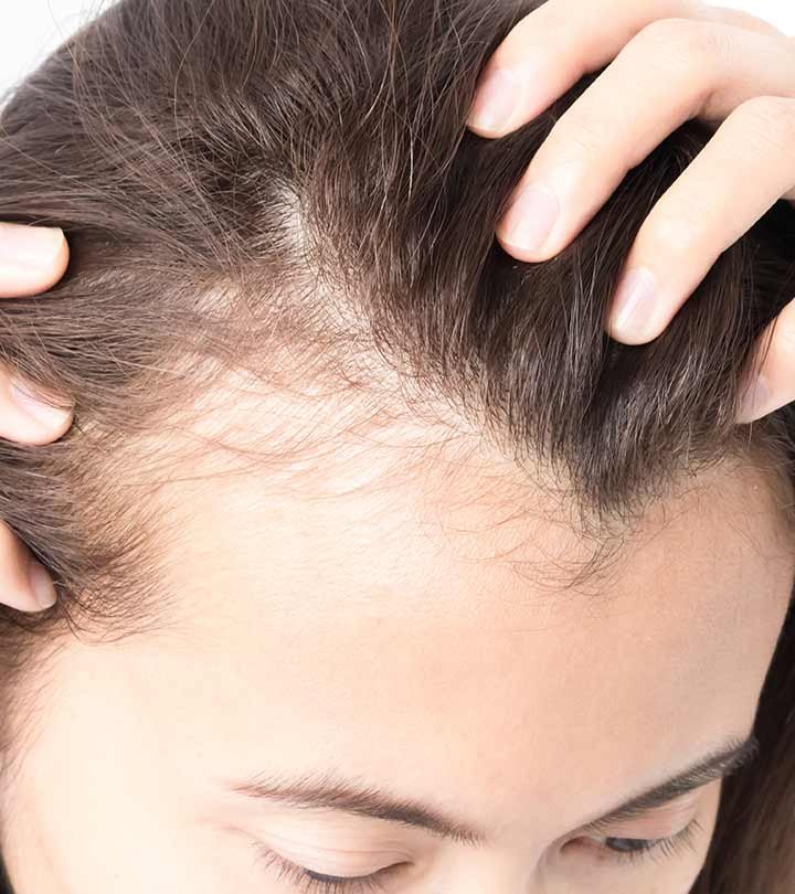 Essential Hair Care Tips for Balding Women