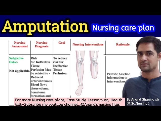 Essential Nursing Considerations for Patients with Amputation