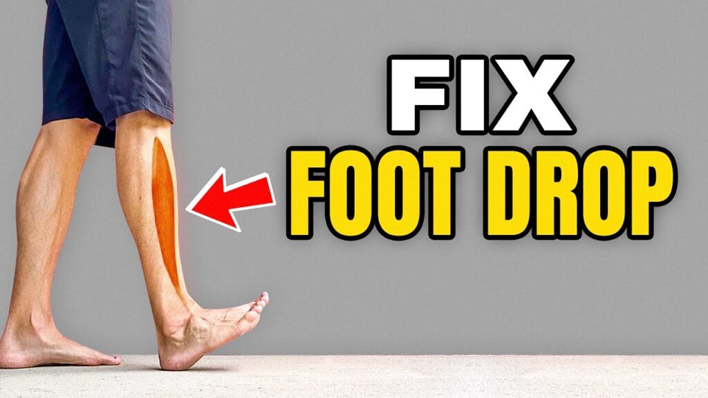 Exercises to Improve Foot Drop
