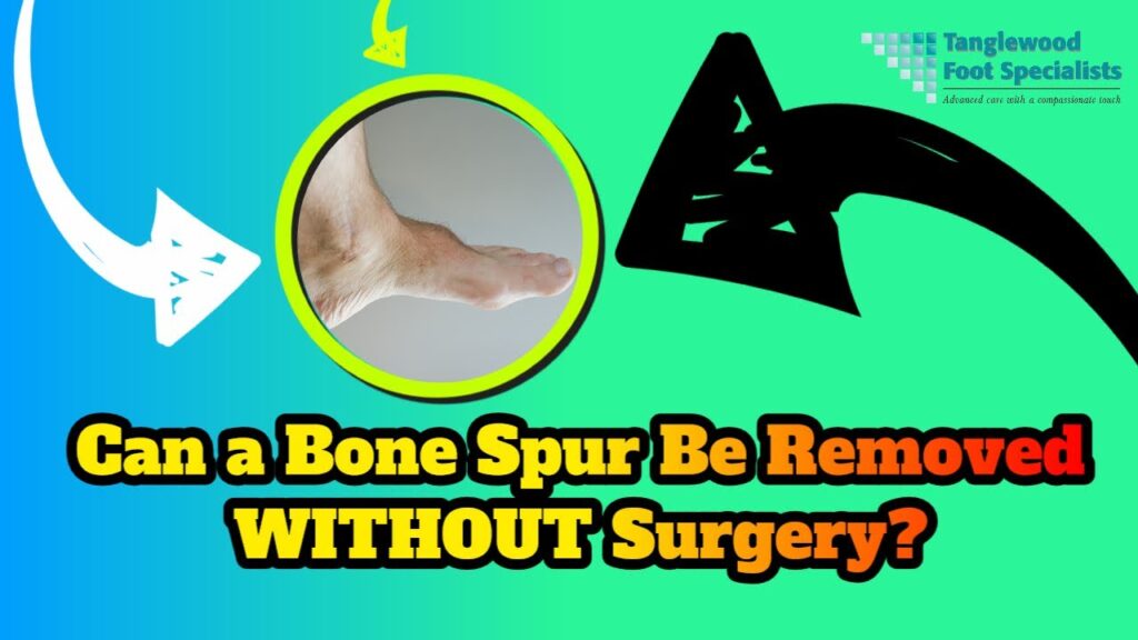 Exploring Non-Surgical Treatments for Bone Spurs
