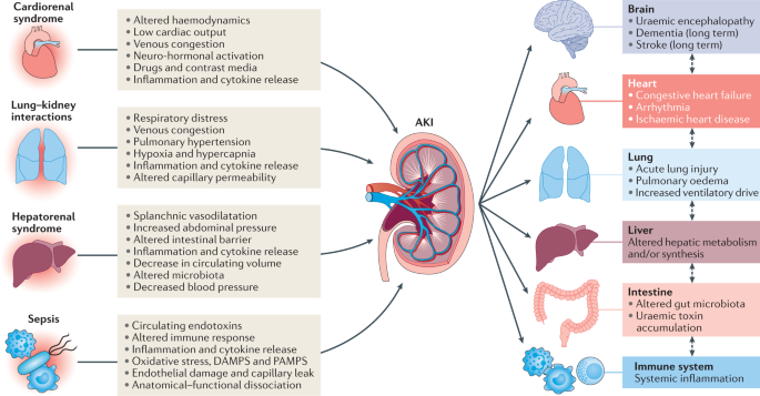 Exploring Recent Advances in Treating Acute Renal Failure