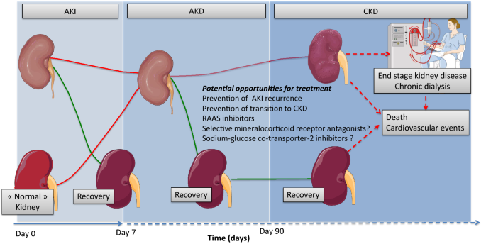 Exploring Recent Advances in Treating Acute Renal Failure