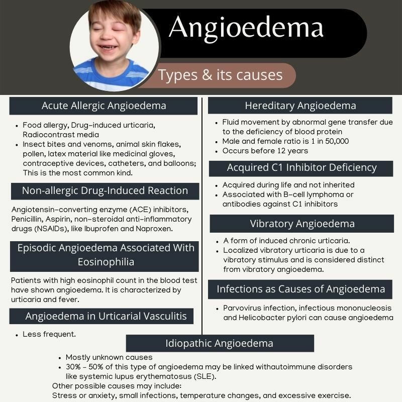 Exploring the Link Between Angioedema and Allergies