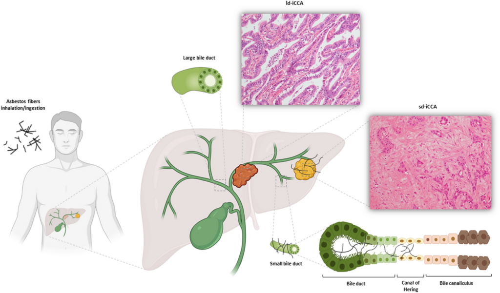 Exploring the Link between Asbestos and Cancer