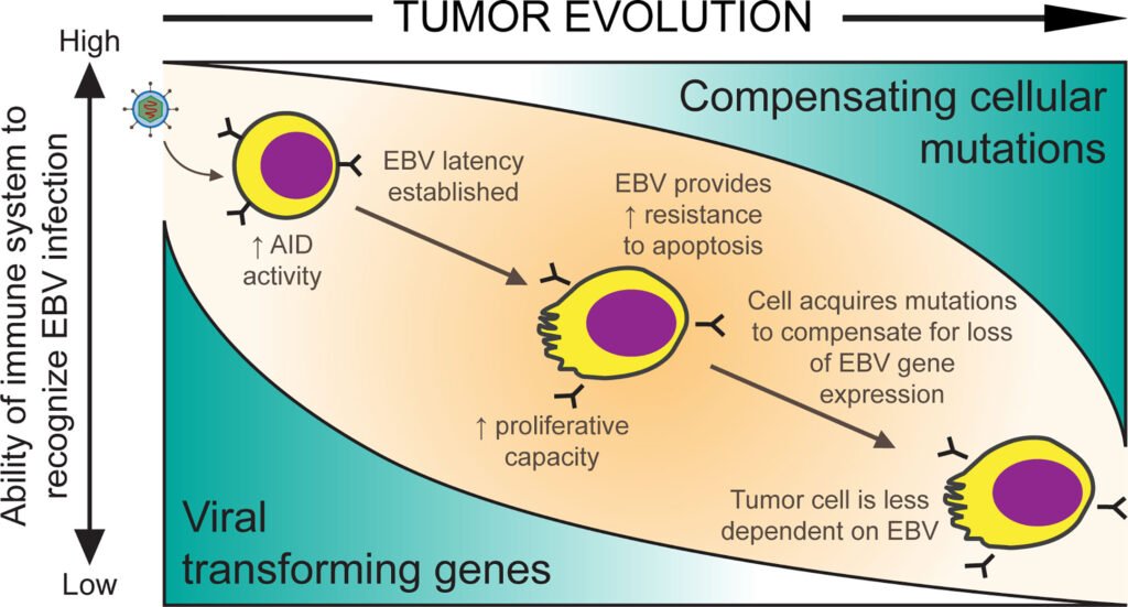 Exploring the Relationship Between Epstein-Barr Virus and Burkitt Lymphoma