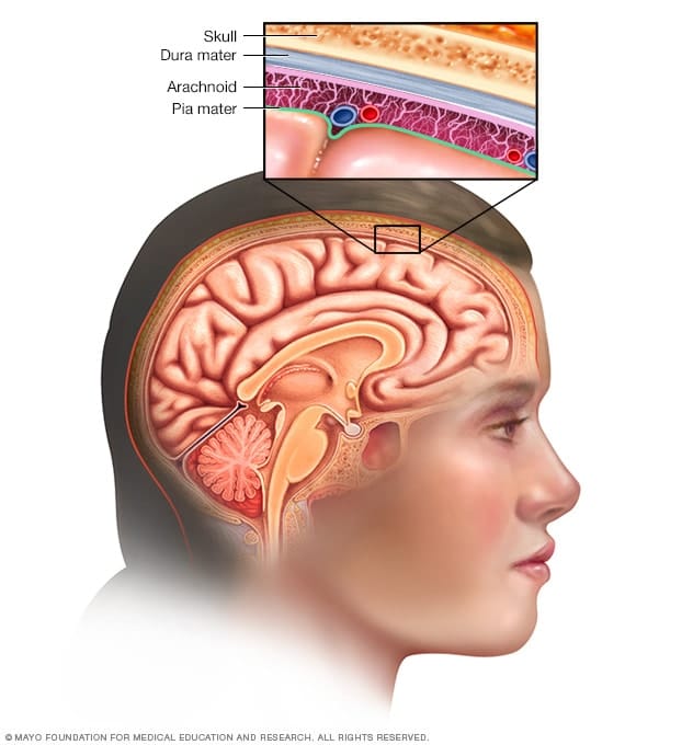 Exploring the Symptoms of Meningioma