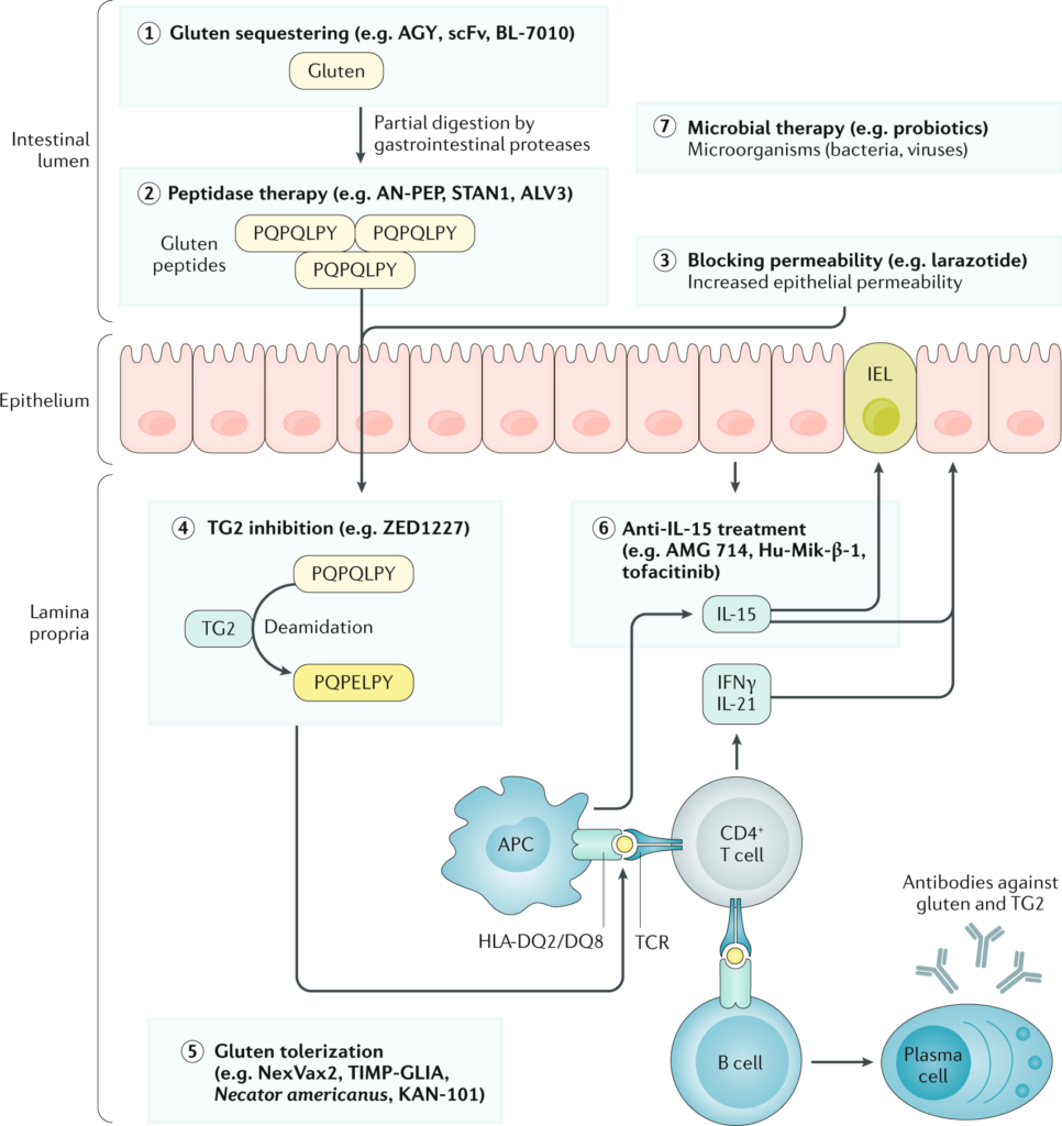 Exploring Treatment Options for Celiac Disease Exploring Treatment Options for Celiac Disease