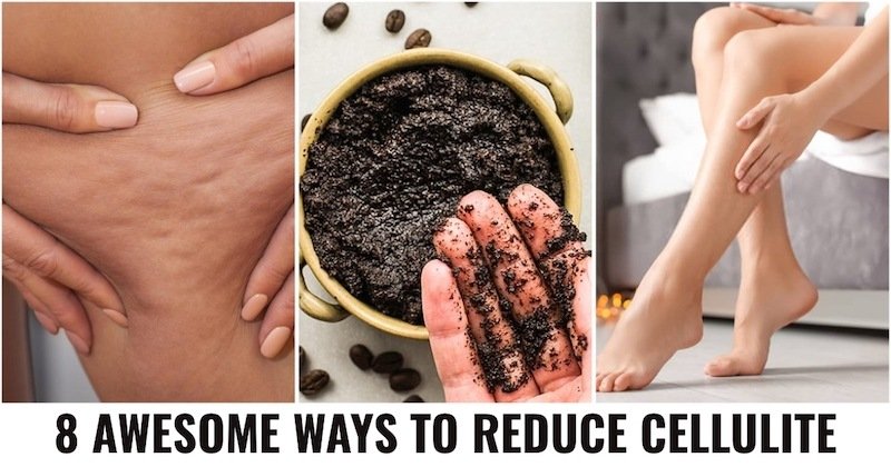 Get Rid of Cellulite: Tips and Tricks That Work