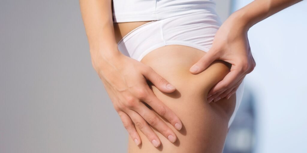 Get Rid of Cellulite: Tips and Tricks That Work