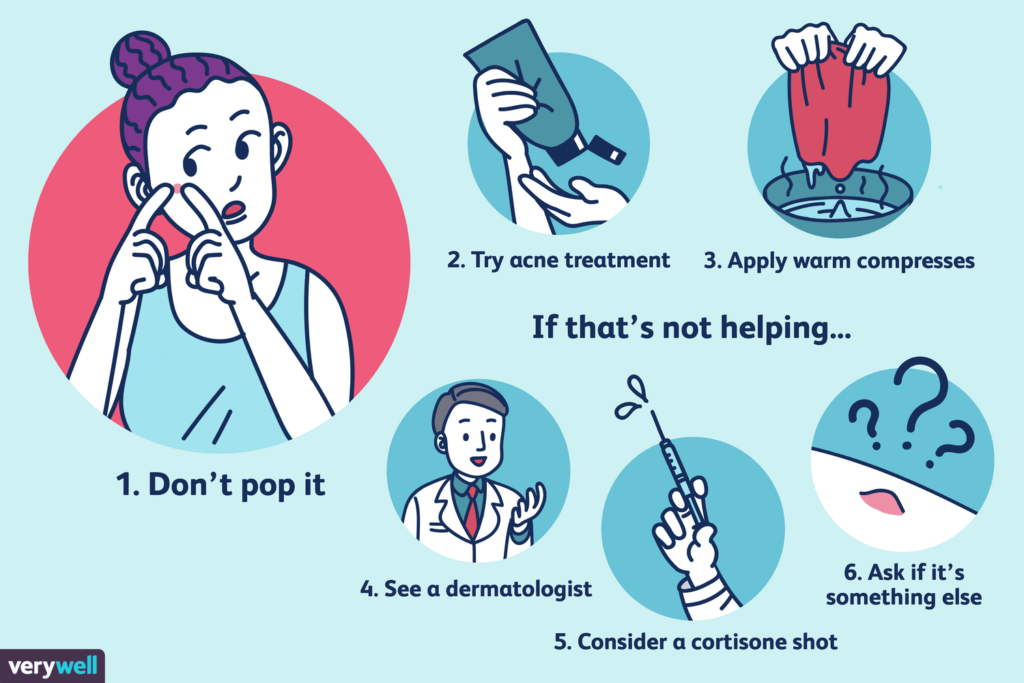 How to Get Rid of Zits How to Get Rid of Zits