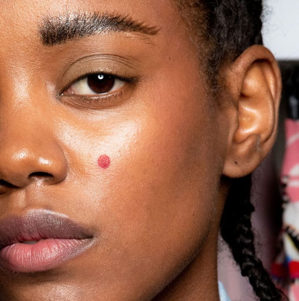 How to Get Rid of Zits How to Get Rid of Zits