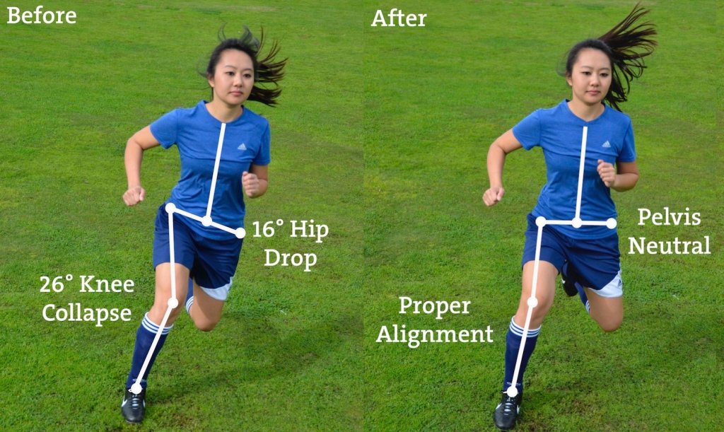 How To Prevent ACL Injuries