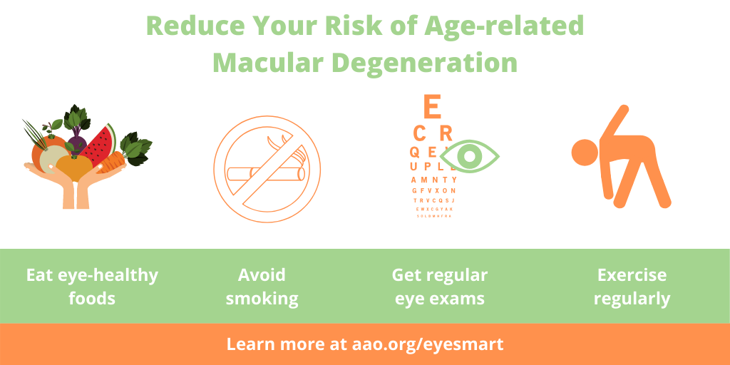 How To Prevent AgeRelated Macular Degeneration Ask The Nurse Expert