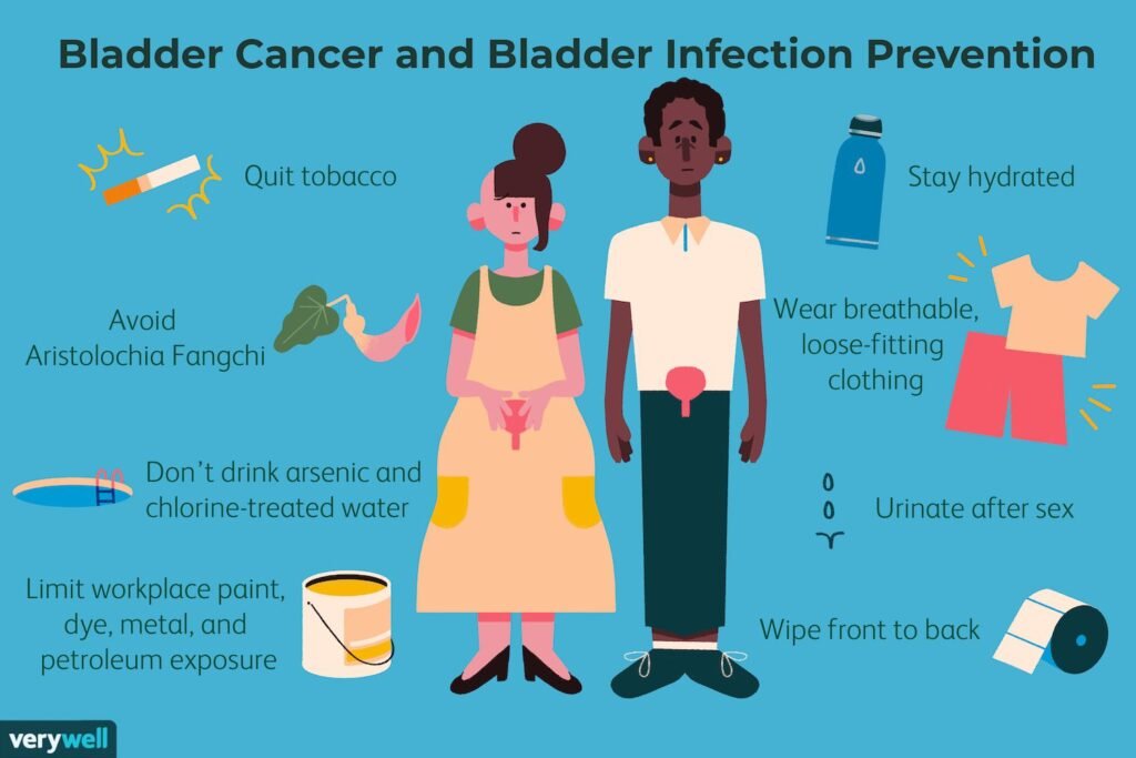 How To Prevent Bladder Cancer
