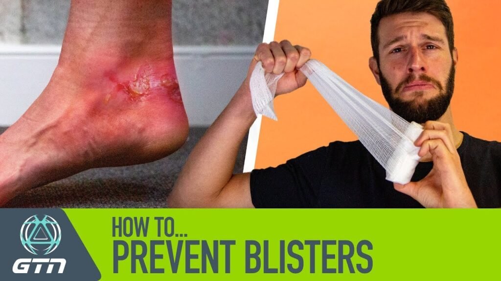 How To Prevent Blisters