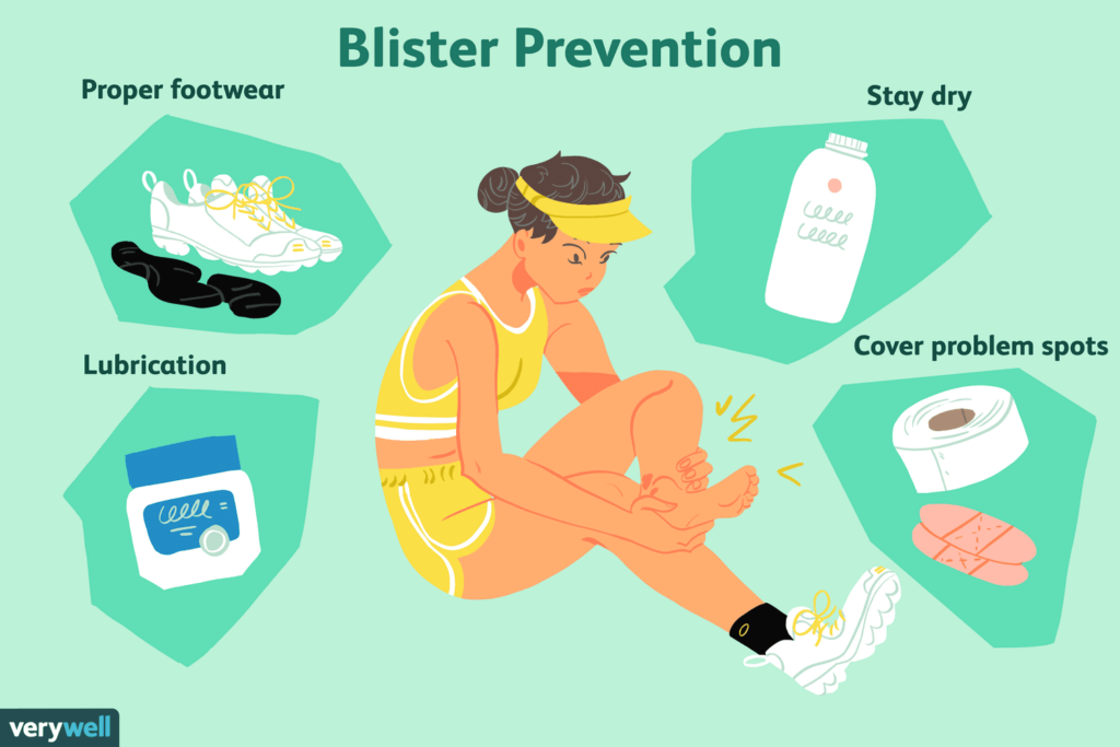 How To Prevent Blisters