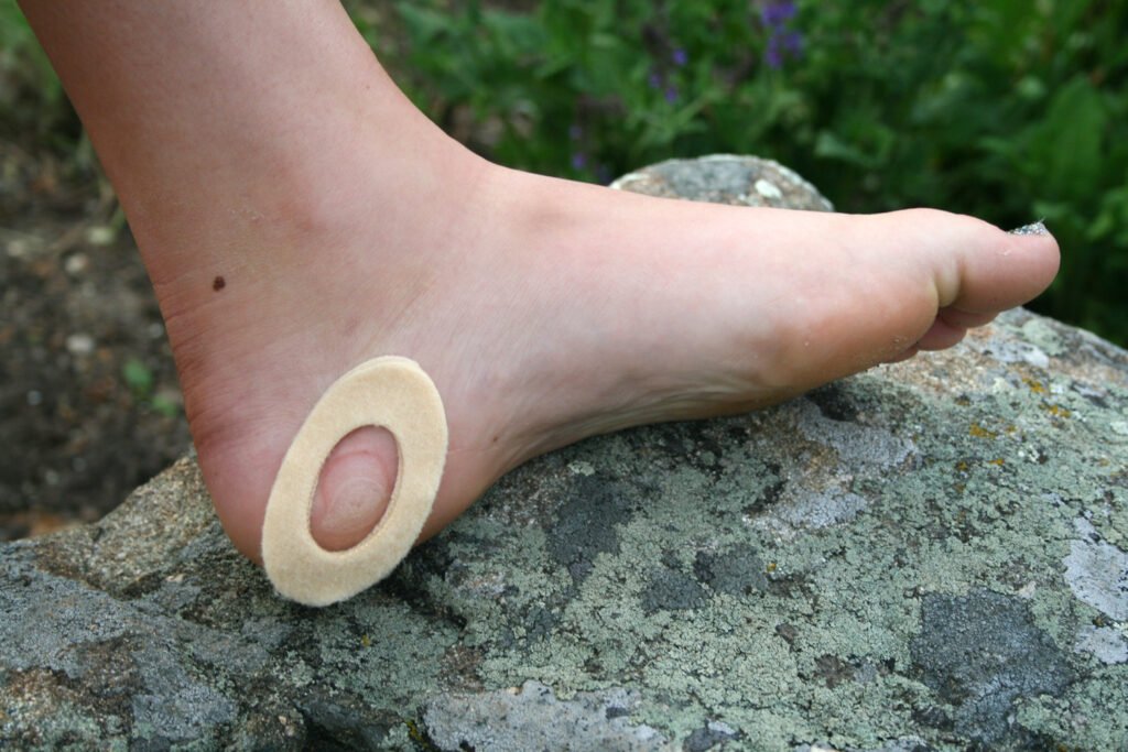 How To Prevent Blisters