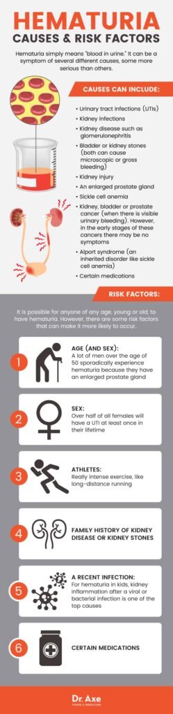 How To Prevent Blood In Urine