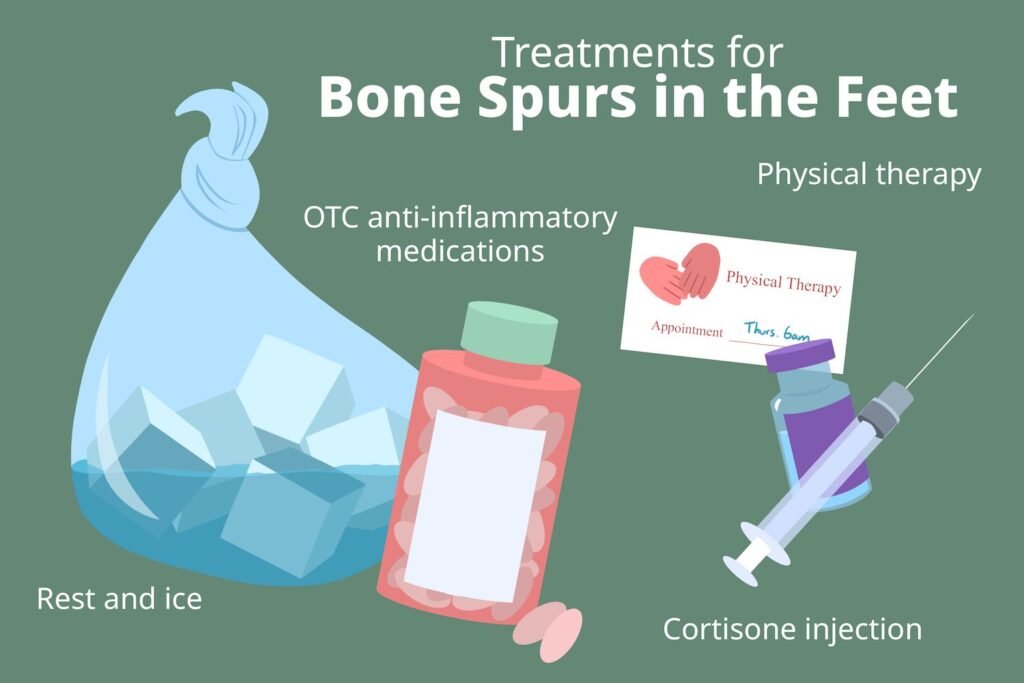 How To Prevent Bone Spurs