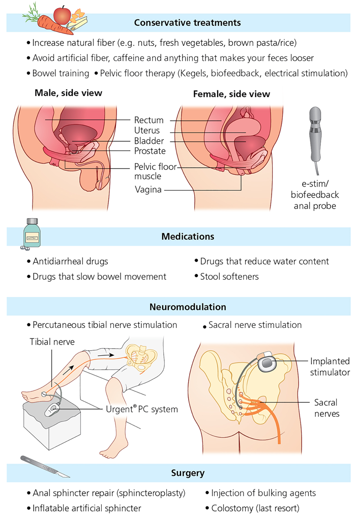 How To Prevent Bowel Incontinence