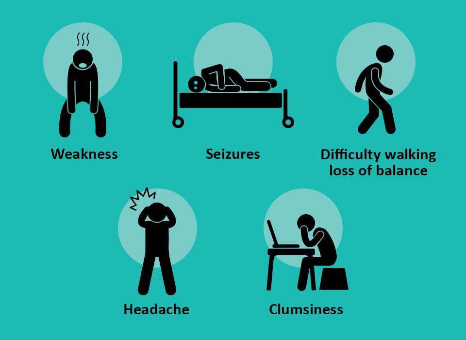How To Prevent Brain Cancer