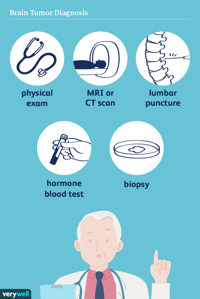 How To Prevent Brain Cancer