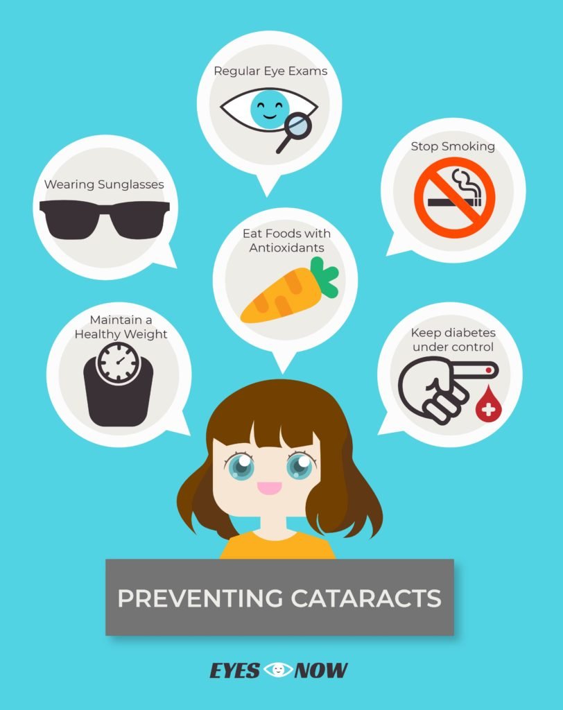 How To Prevent Cataracts