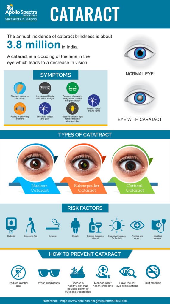 How To Prevent Cataracts