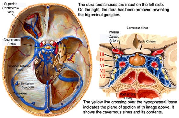 How To Prevent Cavernous Sinus Thrombosis