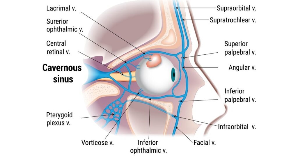 How To Prevent Cavernous Sinus Thrombosis