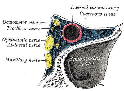 How To Prevent Cavernous Sinus Thrombosis