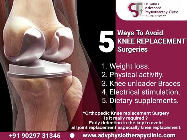 How To Prevent Knee Replacement Surgery