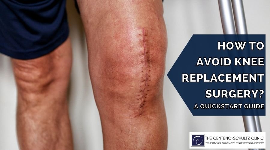 How To Prevent Knee Replacement Surgery