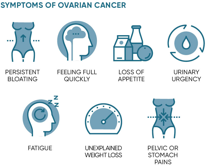 How To Prevent Ovarian Cancer