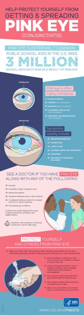 How To Prevent Pink Eye