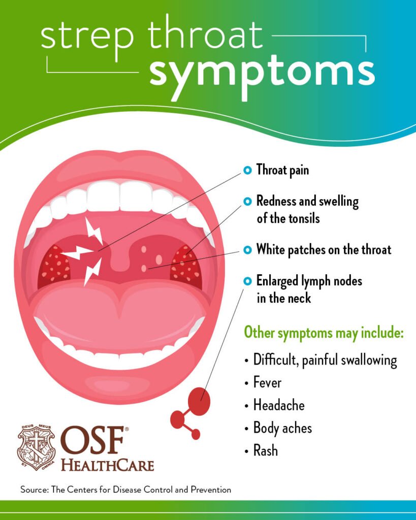 How To Prevent Strep Throat Ask The Nurse Expert How To Prevent Strep Throat Ask The Nurse Expert