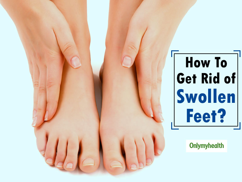 How To Prevent Swollen Feet Or Ankles
