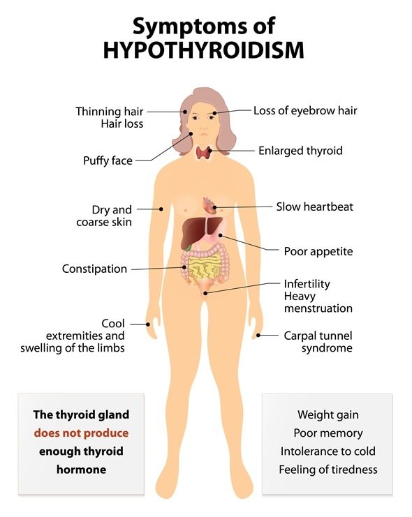 Hyperthyroidism 101: What You Need to Know