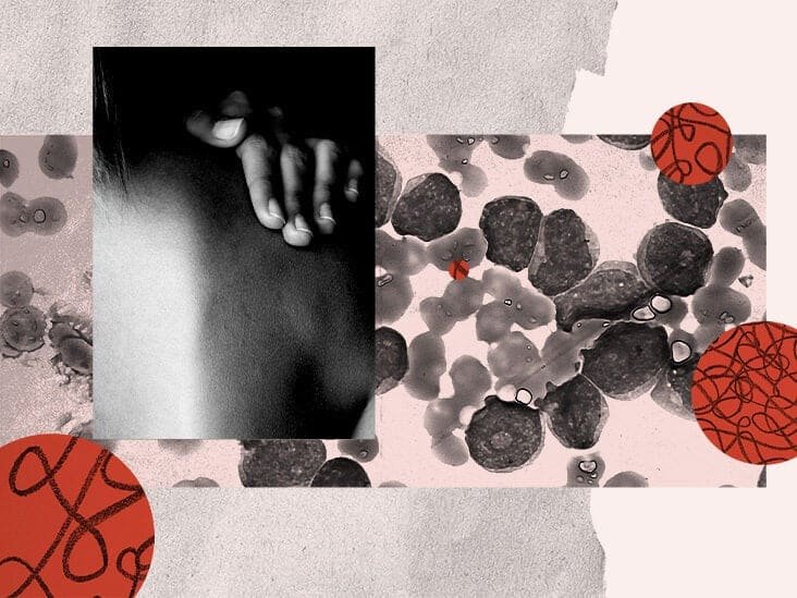 Impact of Leukemia on Daily Life: Emotional and Practical Challenges