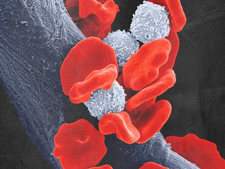 Impact of Leukemia on Daily Life: Emotional and Practical Challenges