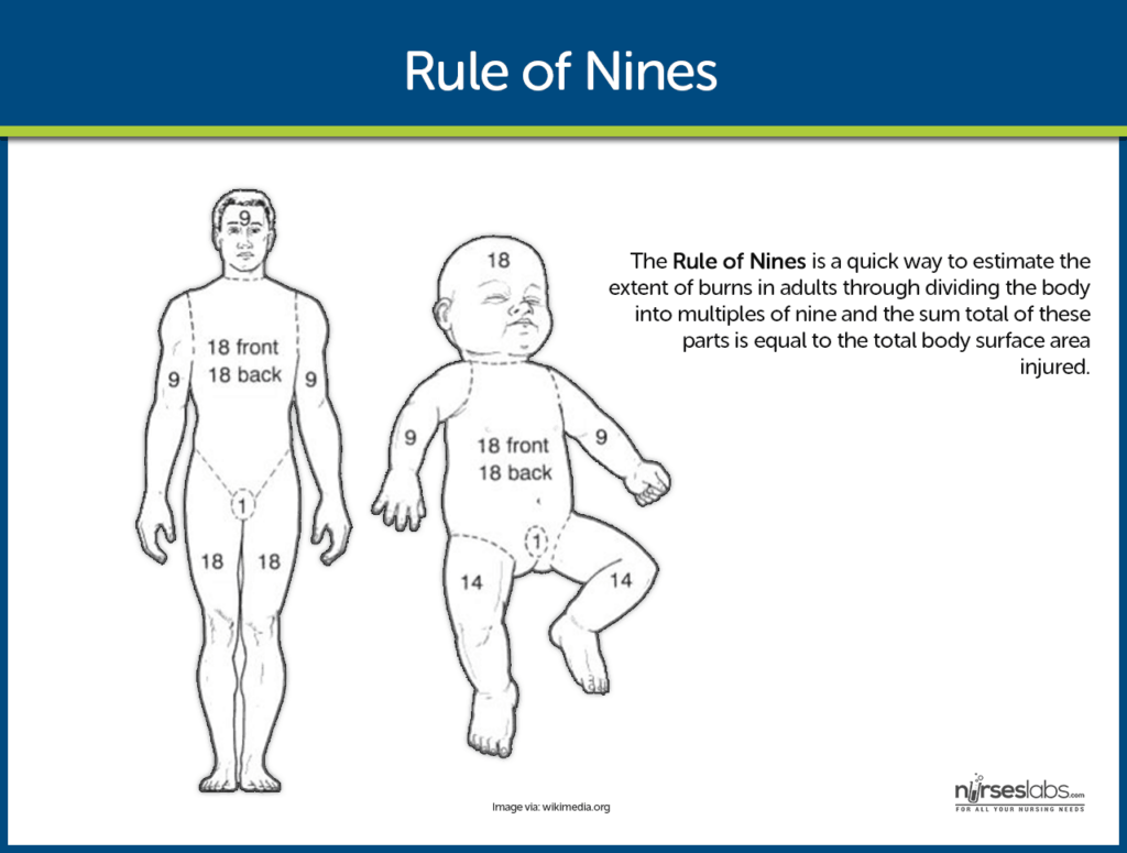 Important Nursing Considerations for Burns Important Nursing Considerations for Burns