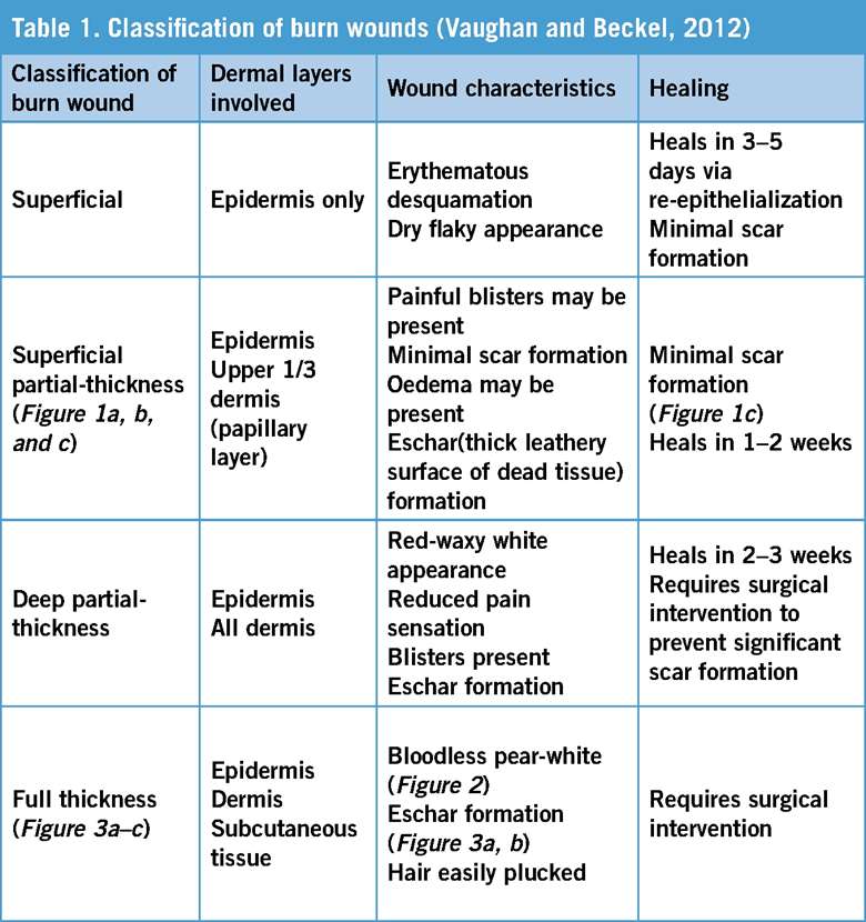 Important Nursing Considerations for Burns Important Nursing Considerations for Burns