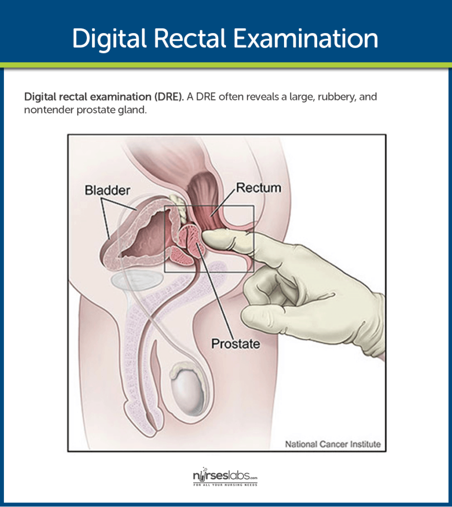 Important Nursing Considerations for Enlarged Prostate