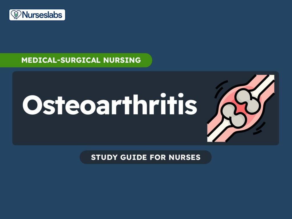 Important Nursing Considerations for Osteoarthritis