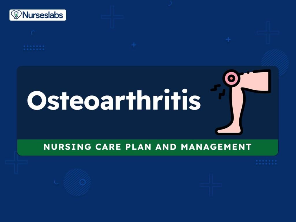 Important Nursing Considerations for Osteoarthritis