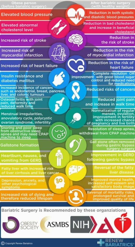 Improving Health with Bariatrics