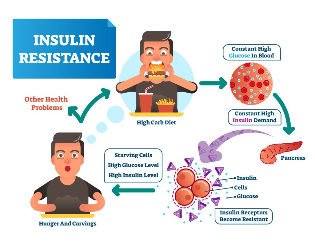 Insulin Resistance and its Impact on Weight Gain