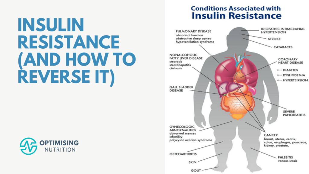 Insulin Resistance and its Impact on Weight Gain